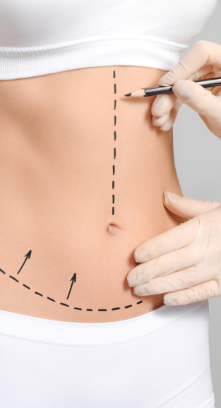 Vanessa Saboun Drainage Lymphatique Paris Assure Des Soins Post Op